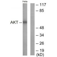 Akt Polyclonal Antibody