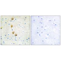 Akt Polyclonal Antibody