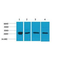 HSP27 Polyclonal Antibody