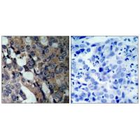 HSP27 Polyclonal Antibody