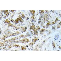 HSP27 Polyclonal Antibody