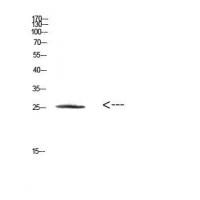 HSP27 Polyclonal Antibody