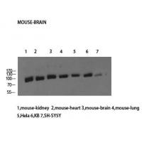 HSP70 Polyclonal Antibody