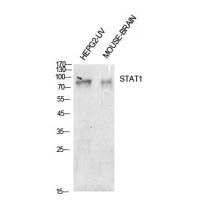 Stat1 Polyclonal Antibody