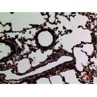 Stat2 Polyclonal Antibody