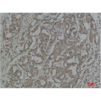 Stat3 Polyclonal Antibody