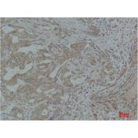 Stat3 Polyclonal Antibody