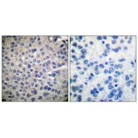 Stat4 Polyclonal Antibody