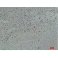 Stat5b Polyclonal Antibody