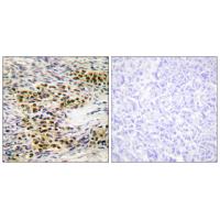 Akt1 Polyclonal Antibody