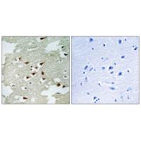 Akt1 Polyclonal Antibody