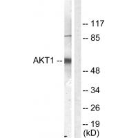 Akt1 Polyclonal Antibody