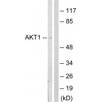 Akt1 Polyclonal Antibody