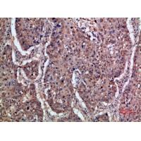 IFN-α/βRα Polyclonal Antibody