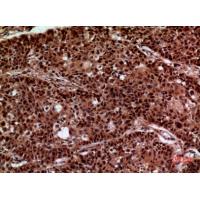 IFN-γRα Polyclonal Antibody