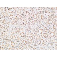 IGFBP3 Polyclonal Antibody