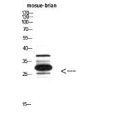 IGFBP3 Polyclonal Antibody