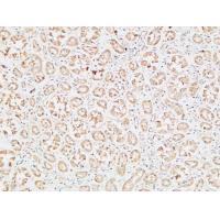 IGFBP3 Polyclonal Antibody