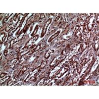 IGFBP3 Polyclonal Antibody