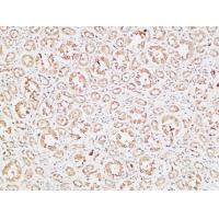 IGFBP3 Polyclonal Antibody