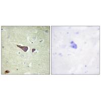 IGF-IIR Polyclonal Antibody