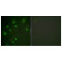 IGF-IIR Polyclonal Antibody