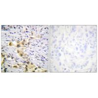 IGF-IIR Polyclonal Antibody