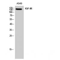 IGF-IR Polyclonal Antibody