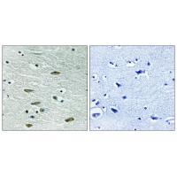 IGF-IR Polyclonal Antibody