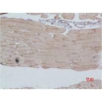 IGFN1 Polyclonal Antibody