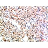 IkB α Rabbit Polyclonal Antibody