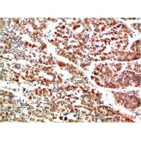 IkB α Rabbit Polyclonal Antibody