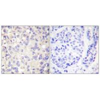 IKKβ Polyclonal Antibody