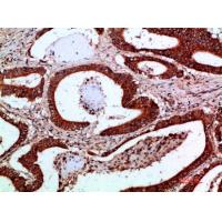 IKKγ Polyclonal Antibody