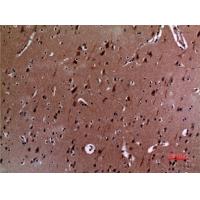 IL-12A p35 Polyclonal Antibody