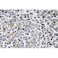 IL-16 Polyclonal Antibody