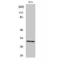 IL-1β Polyclonal Antibody