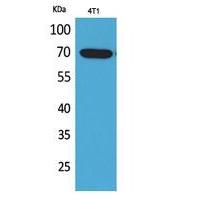 Amphiphysin II Polyclonal Antibody