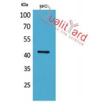 α-SMA Polyclonal Antibody