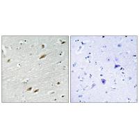 FoxO1 Polyclonal Antibody