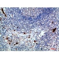 ZAP-70 Polyclonal Antibody