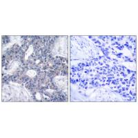 ZAP-70 Polyclonal Antibody