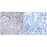 ZAP-70 Polyclonal Antibody