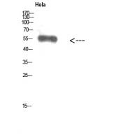 Vimentin Polyclonal Antibody