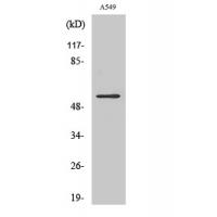 Vimentin Polyclonal Antibody