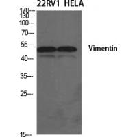 Vimentin Polyclonal Antibody