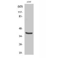 Vimentin Polyclonal Antibody