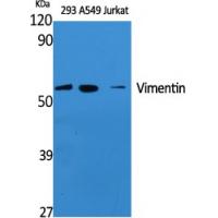 Vimentin Polyclonal Antibody