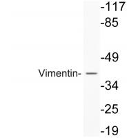 Vimentin Polyclonal Antibody