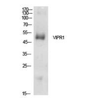 VPAC1 Polyclonal Antibody